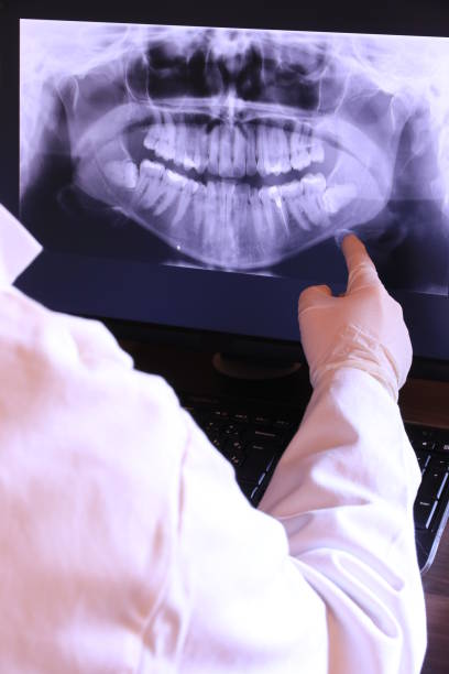 Best Broken or Cracked Tooth Emergency Dentist in Florence, MS