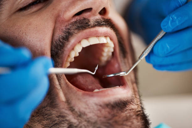 Best Emergency Dental Services for Seniors in Florence, MS